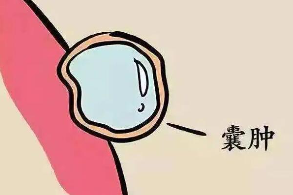 女性有生理性的5毫米右附件囊肿可以进行试管移植吗？
