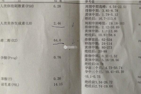 男性性激素六项中睾酮异常对试管婴儿成功率的影响