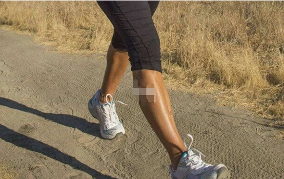 人工授精移植后不限制行走，适当散步好处可不少？