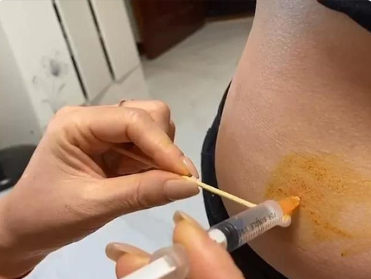 [试管婴儿降调注意事项以及期间饮食禁忌]