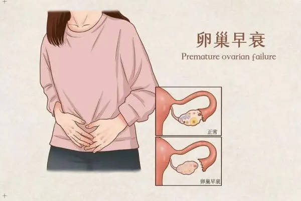 AMH0.29可以做试管怀孕