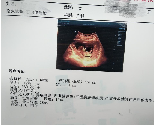 揭秘nt值看男女85%的准确率!
