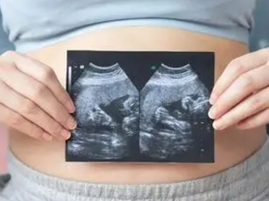 自然备孕怀双胞胎取决于妈妈还是爸爸的基因？