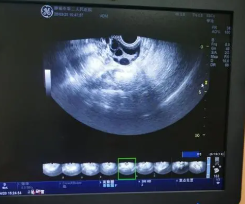 自测排卵的八个最准确方法分享，用排卵试纸操作简单
