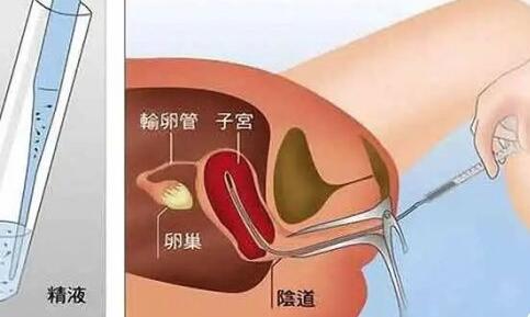 在重医附二院生殖科做一代试管治疗全程多少钱？