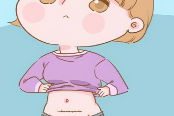剖腹产后建议隔两年再怀孕