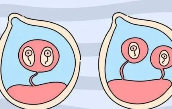 试管婴儿技术的风险比自然受孕高