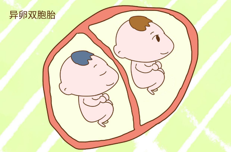 做孕检B超显示异卵双胞胎是怎么成功怀上的？