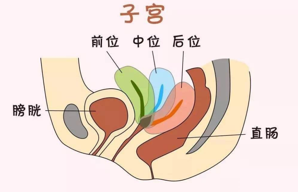子宫后位怎么容易怀孕？最佳受孕方法安排上了