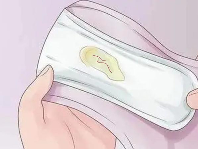有黄色分泌物可能是严重