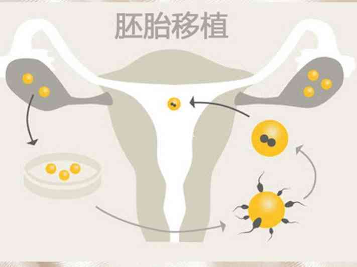 治疗阴道炎用途的甲硝唑栓使用不会影响胚胎着床