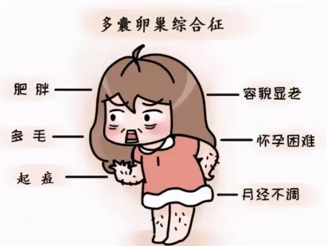 amh检查结果5点多怎么知道自己是不是多囊卵巢综合征呢？