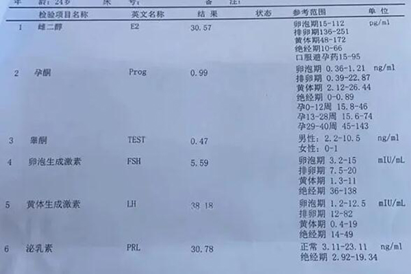 FSH是调控女性卵巢功能的激素