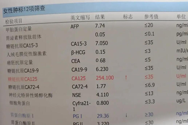 ca125偏高不能做试管移植