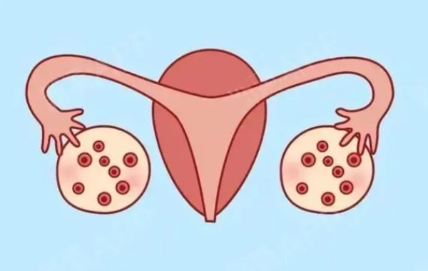 36岁女性多囊做一代试管适合移植什么发育类型的胚胎呢？