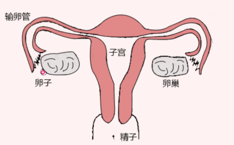输卵管造影检查详细步骤，做完输卵管造影建议三个月后要孩子