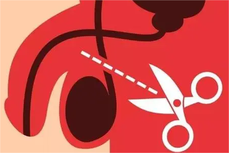为什么现在男科医院并不提倡男性结扎?