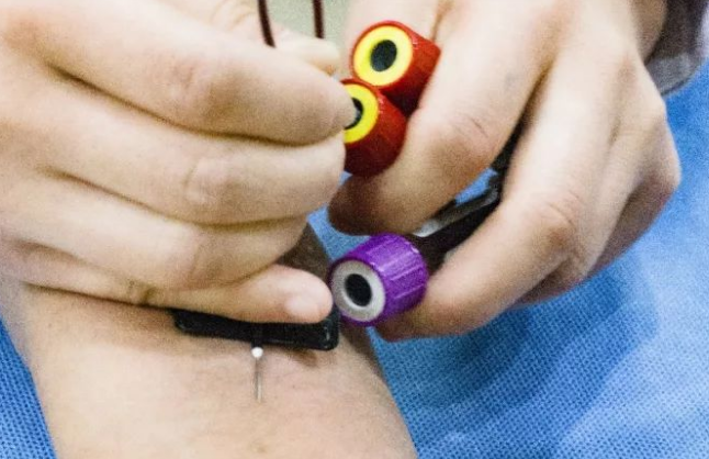 为什么说刚做完试管移植千万别太早去医院抽血查早孕呢？