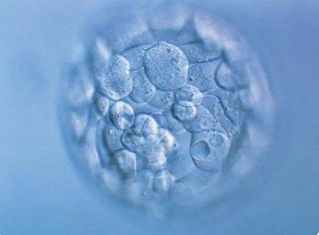 13-三体综合征患者想要孩子可以做试管婴儿吗?