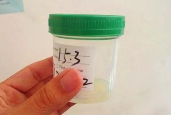 激素检查有效期1年