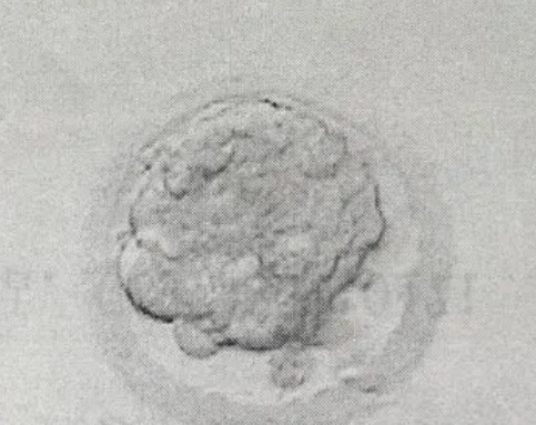 试管养成囊胚4bc是精子差还是卵子差？
