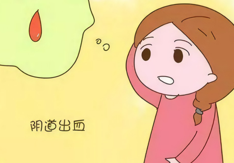 排卵期出血可能是点滴即净