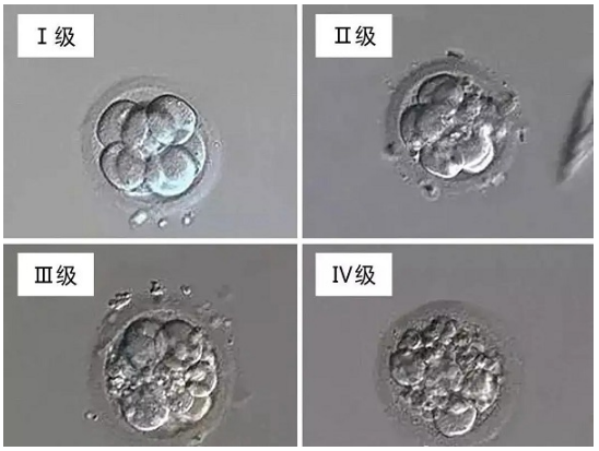 [胚胎质量等级怎么划分?详解]