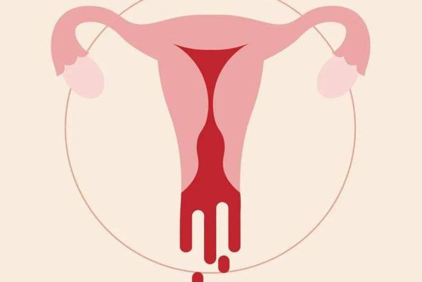 绝经后女性会出现子宫出血
