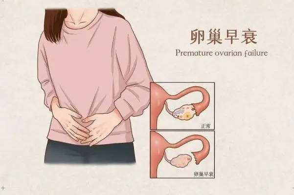 汗毛增多可能是dhea副作用引起