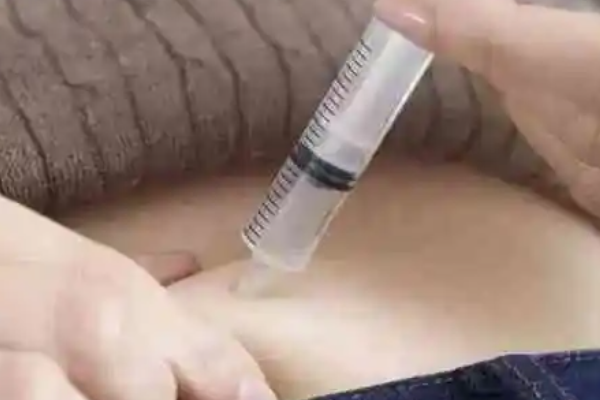 促排打针的部位一般是在腹部