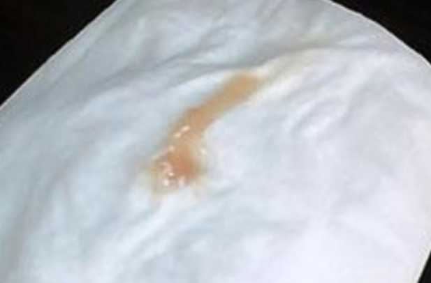 胚胎未着床分泌物会有异味