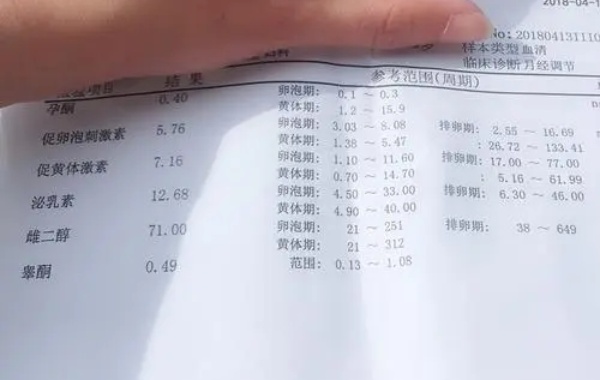 34岁性激素六项结果用fsh除以lh大于2就是不正常吗？