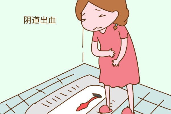 雪诺酮能减缓阴道出血症状