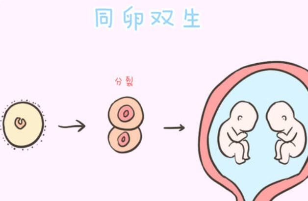 为什么说怀同卵双胞胎很吓人呢？