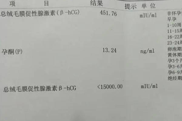 都说孕酮低会生男孩，怀儿子和女儿的差异是否真的很大