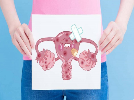 双侧卵巢多卵泡是什么意思？