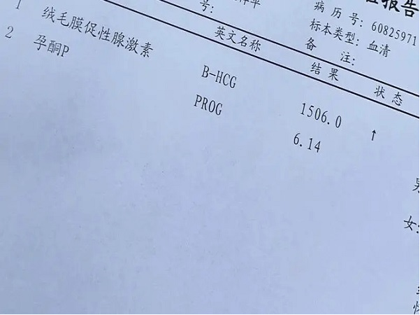 试管打完夜针后看hcg高低，有意义吗？