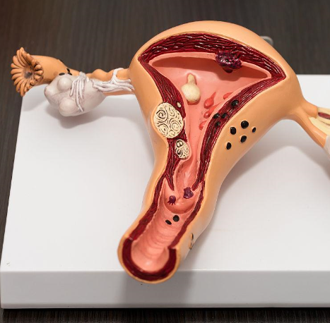 保养子宫卵巢最有效15种食物，鱼肉、豆类成子宫最爱