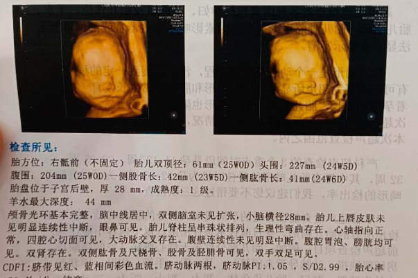 为什么有些公立医院会禁止孕妇做四维检查呢？