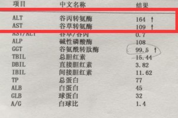 备孕期间查肝功能检查结果出来转氨酶140多严重吗？