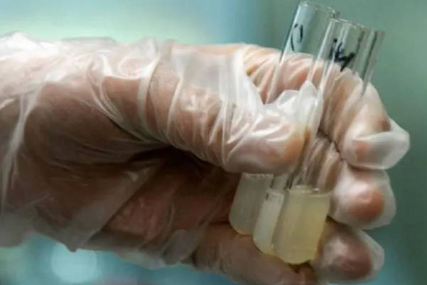 试管婴儿可帮助先天死精患者受孕