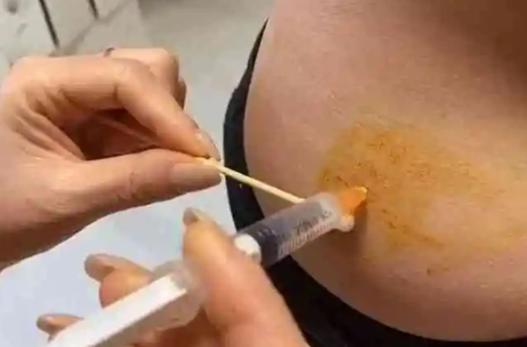 试管长方案中的促排针普丽康是进口的还是国产的？