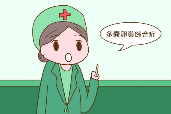 多囊卵巢综合症