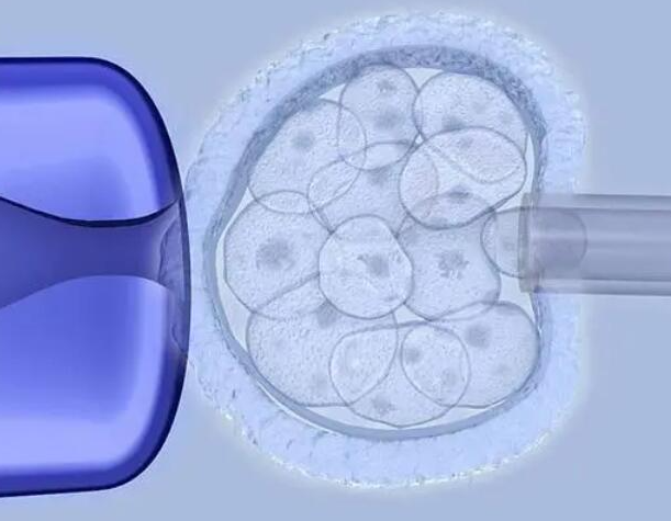 第三代试管女性受罪吗，最难的环节是什么？