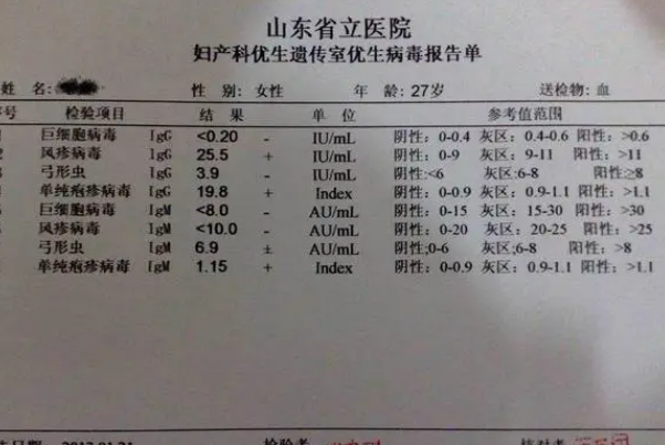 优生优育要检查弓形体病毒