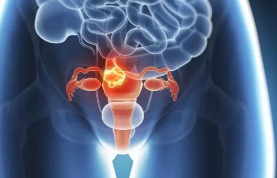 女性做三代试管需子宫正常