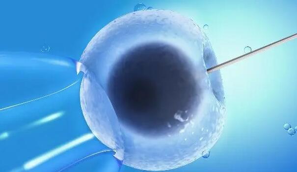 2024同性恋能去俄罗斯做试管吗？附详细流程！