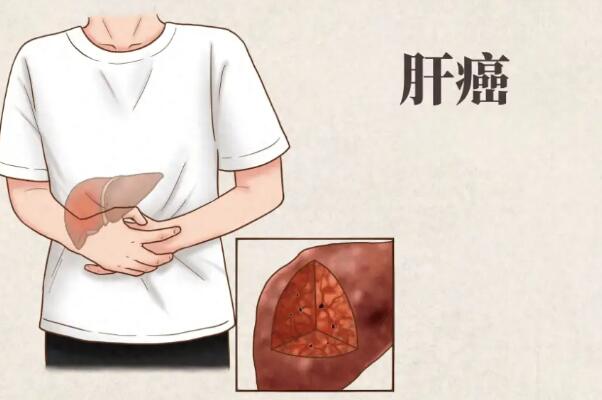 甲胎蛋白可用于肝癌诊断
