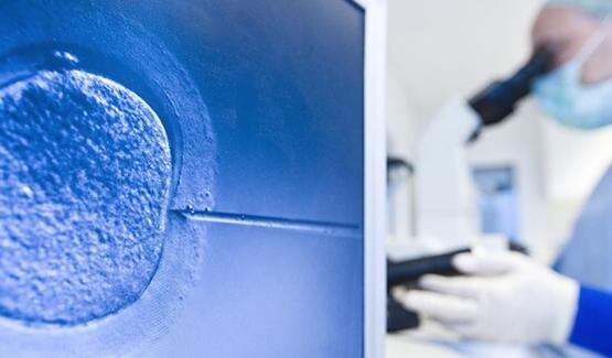 精液检查显示精子质量差的男性合适做试管几代？