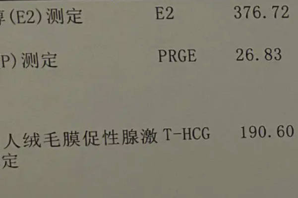 15天检查HCG值在300以上预后相对较好